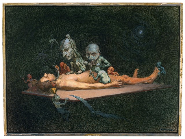 Richard Tennant Cooper - An unconscious naked man lying on a table being attacked by little demons armed with surgical instruments; symbolising the effect of chloroform on the human body